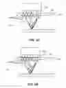 Fig. 88 - System and method for optogenetic therapy
