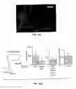 Fig. 02 - Implantable prosthetic device comprising a cell expressing a channelrhodopsin