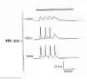 Fig. 04 - Implantable prosthetic device comprising a cell expressing a channelrhodopsin