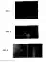Fig. 10 - Implantable prosthetic device comprising a cell expressing a channelrhodopsin