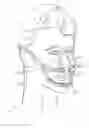 Fig. 01 - METHODS USEFUL FOR REMODELING MAXILLOFACIAL BONE USING LIGHT THERAPY AND A FUNCTIONAL APPLIANCE