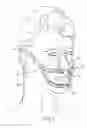 Fig. 02 - METHODS USEFUL FOR REMODELING MAXILLOFACIAL BONE USING LIGHT THERAPY AND A FUNCTIONAL APPLIANCE