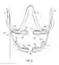 Fig. 03 - METHODS USEFUL FOR REMODELING MAXILLOFACIAL BONE USING LIGHT THERAPY AND A FUNCTIONAL APPLIANCE