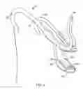 Fig. 05 - METHODS USEFUL FOR REMODELING MAXILLOFACIAL BONE USING LIGHT THERAPY AND A FUNCTIONAL APPLIANCE