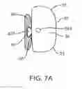 Fig. 08 - METHODS USEFUL FOR REMODELING MAXILLOFACIAL BONE USING LIGHT THERAPY AND A FUNCTIONAL APPLIANCE