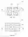 Fig. 16 - METHODS USEFUL FOR REMODELING MAXILLOFACIAL BONE USING LIGHT THERAPY AND A FUNCTIONAL APPLIANCE