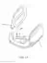 Fig. 18 - METHODS USEFUL FOR REMODELING MAXILLOFACIAL BONE USING LIGHT THERAPY AND A FUNCTIONAL APPLIANCE