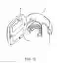 Fig. 19 - METHODS USEFUL FOR REMODELING MAXILLOFACIAL BONE USING LIGHT THERAPY AND A FUNCTIONAL APPLIANCE