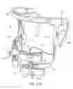 Fig. 27 - METHODS USEFUL FOR REMODELING MAXILLOFACIAL BONE USING LIGHT THERAPY AND A FUNCTIONAL APPLIANCE