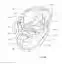 Fig. 148 - Face soaking device