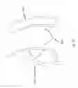 Fig. 18 - Projectile and Throwing Apparatus and Game for Projectile Throwing