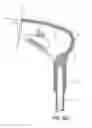 Fig. 82 - Projectile and Throwing Apparatus and Game for Projectile Throwing
