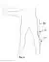 Fig. 08 - GOLF SWING TRAINING GUIDE