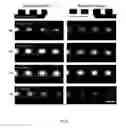 Fig. 12 - Method and apparatus for the discretization and manipulation of sample volumes