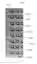 Fig. 43 - Method and apparatus for the discretization and manipulation of sample volumes