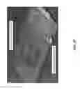 Fig. 34 - HEATER UNIT FOR MICROFLUIDIC DIAGNOSTIC SYSTEM