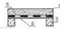Fig. 01 - Method of manufacturing an artificial elastic implant for restorative an reconstructive surgery