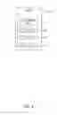 Fig. 04 - Stent thermoforming apparatus and methods