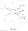 Fig. 22 - Glue application method for cold seal cohesive packaging