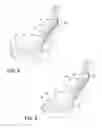Fig. 07 - Torsion bar upper seatback support assembly