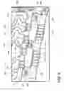 Fig. 05 - Tuned flexible support member and flexible suspension features for comfort carriers