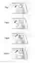 Fig. 04 - WINDSCREEN WIPER, SYSTEM AND METHOD FOR WIPING A GLAZED MOTOR VEHICLE SURFACE