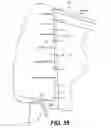 Fig. 24 - AERODYNAMIC TRACTOR-TRAILER GAP REDUCER AND ASSEMBLY THEREOF