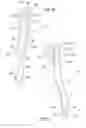 Fig. 06 - Bicycle control lever and method for manufacturing it