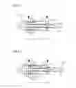 Fig. 08 - Hydraulic actuator
