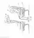 Fig. 04 - Active positioning airbag assembly and associated systems and methods