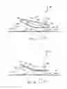 Fig. 11 - Apparatus and method for transferring a pattern from a universal surface to an ultimate package