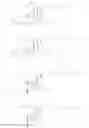 Fig. 20 - Cationic steroidal antimicrobial prodrug compositions and uses thereof