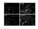 Fig. 08 - Mussel-inspired bioactive surface coating composition generating silica nanoparticles