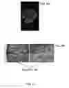Fig. 13 - CHLOROTOXIN CONJUGATES AND METHODS OF USE THEREOF
