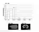 Fig. 14 - CHLOROTOXIN CONJUGATES AND METHODS OF USE THEREOF