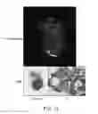 Fig. 15 - CHLOROTOXIN CONJUGATES AND METHODS OF USE THEREOF