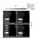 Fig. 18 - CHLOROTOXIN CONJUGATES AND METHODS OF USE THEREOF