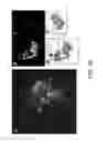 Fig. 41 - CHLOROTOXIN CONJUGATES AND METHODS OF USE THEREOF