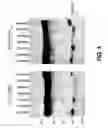 Fig. 07 - COMPOSITIONS AND METHODS OF TREATING DISEASE WITH FGFR FUSION PROTEINS