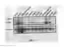 Fig. 06 - B7-H1, A NOVEL IMMUNOREGULATORY MOLECULE