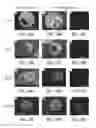 Fig. 08 - Nanofibrous spongy microspheres