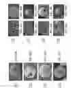 Fig. 12 - Nanofibrous spongy microspheres