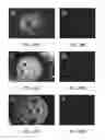 Fig. 14 - Nanofibrous spongy microspheres