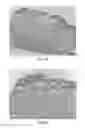 Fig. 04 - Engineered renal tissues, arrays thereof, and methods of making the same