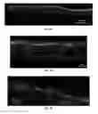 Fig. 10 - Engineered renal tissues, arrays thereof, and methods of making the same