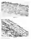 Fig. 12 - Engineered renal tissues, arrays thereof, and methods of making the same