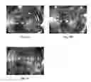 Fig. 15 - Engineered renal tissues, arrays thereof, and methods of making the same