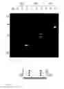 Fig. 16 - Methods for multiplexing recombinase polymerase amplification