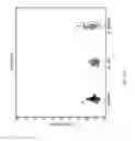 Fig. 26 - Biomarkers for the molecular classification of bacterial infection