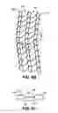 Fig. 12 - Knit article of apparel and apparel printing system and method